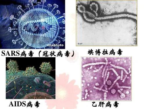 澳洲狗头蝙蝠百度百科:澳大利亚狗头蝙蝠有多少 艾滋病源自非洲大猩猩，它们是如何将病毒传染给人类的？