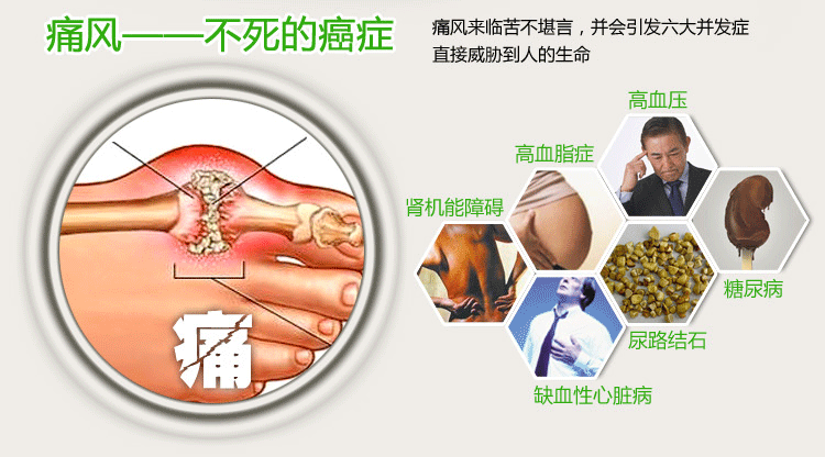 头条问答 - 尿酸高别慌,5种食物多吃一点,尿酸悄悄降下来,痛风远离你