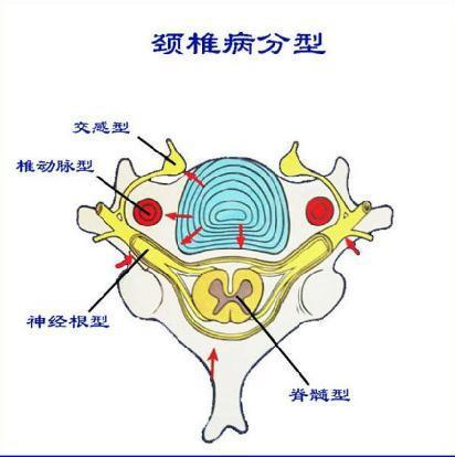 惊吓过度导致后背疼痛怎么办:后背疼痛靠什么最管用？为什么？