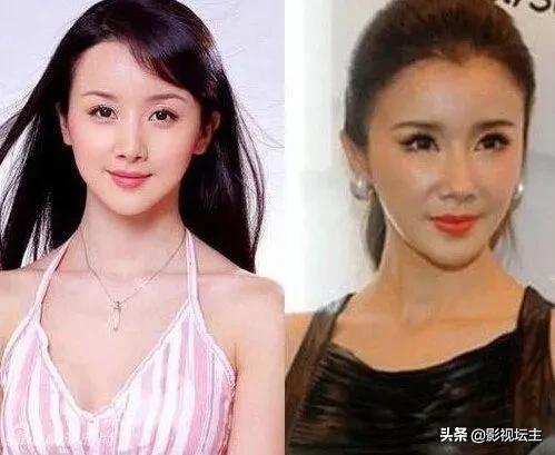 熊黛林整容前:各位怎么看明星或演员整容？