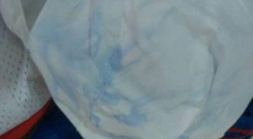 衣服染色去除小窍门:衣服染色去除小窍门，如何避免白色衣物染色？