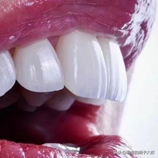 洗牙之前:八岁半的孩子牙齿很黄，有牙结石，可以洗牙吗？
