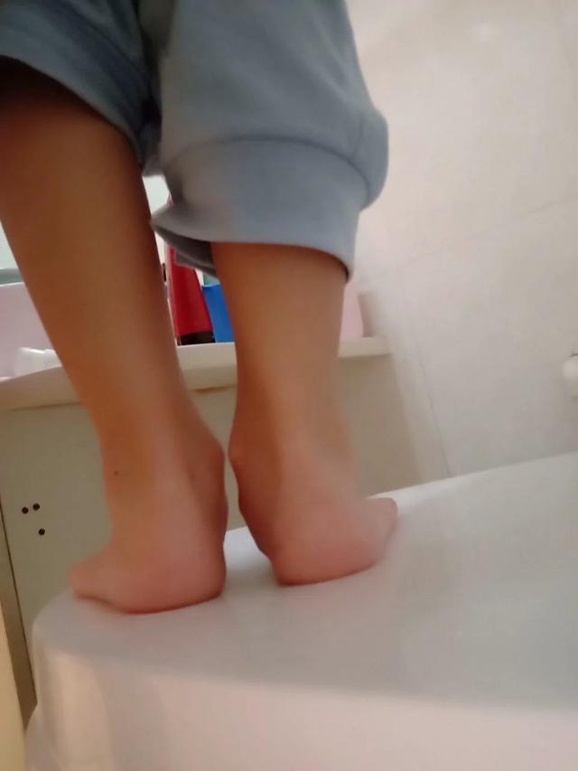 成年25岁女孩足外翻病,影响工作和生活吗?将来老了怎么办?-惠修网