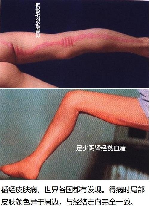 李莉波:如何看待科学家张维波的研究认为人体经络就是人体内的组织液这一说法？