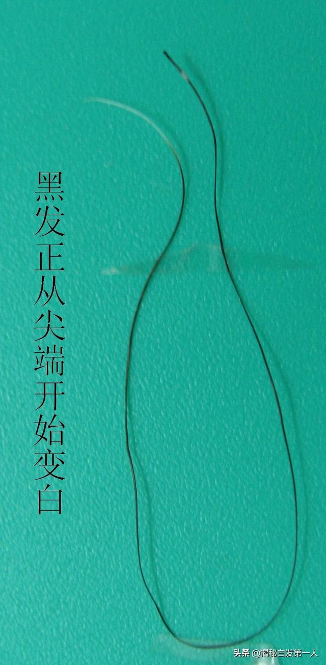岁月催人老,四十来岁额头长了白发什么原因这年龄长白发正常吗？