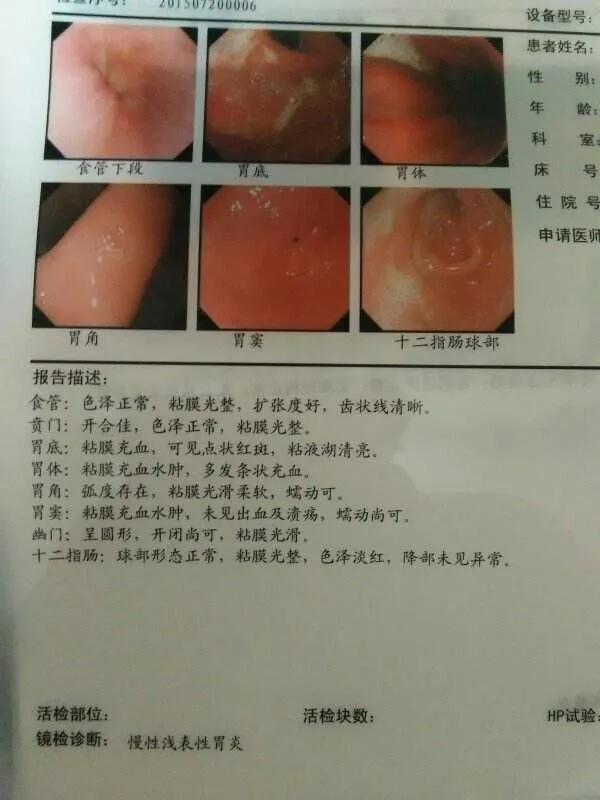 消化系统常见疾病的饮食指导:消化系统疾病与饮食营养 慢性浅表性胃炎，怎么调理，饮食上该怎么注意？