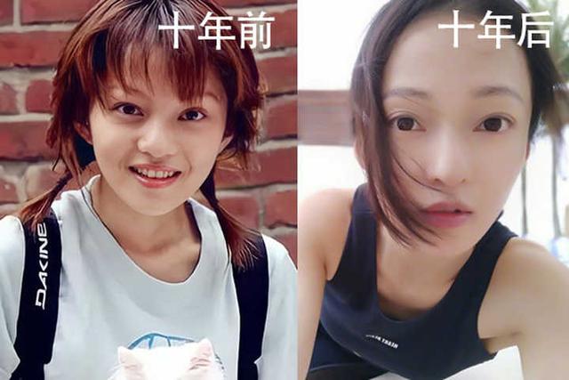 棉尾兔几美拍:哪些大牌女星的玻尿酸脸“崩塌了”？