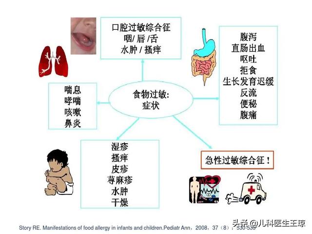 新生儿佝偻病:新生儿佝偻病早期症状 郴州问题奶粉导致婴儿染上佝偻病，你怎么看？