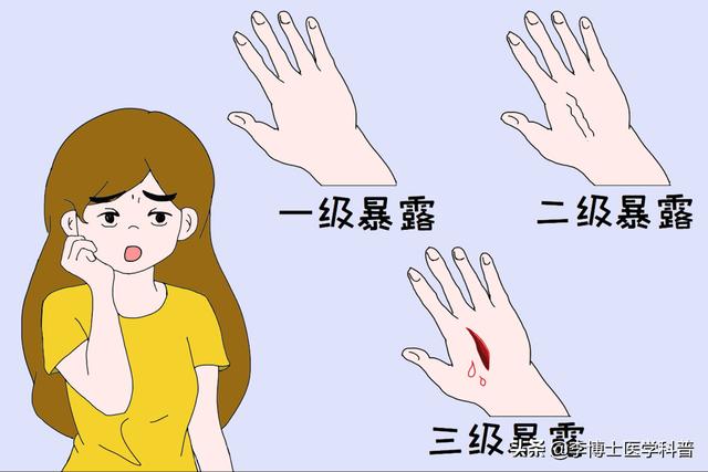 搓手猫现在怎么了:孩子被猫抓伤一个月了，没注射疫苗现在心里非常紧张，怎么办？