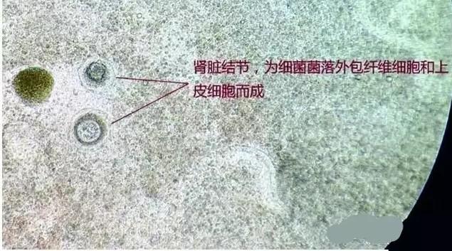 成吉思汗鱼白点病症状:观赏鱼患上了白点病，治疗期间鱼食照喂不误可以吗？