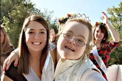 生育了一个唐氏综合征的宝宝我该如何面对