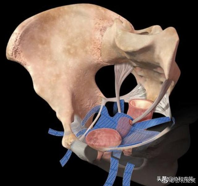 头条问答 产后尿失禁怎么办 41个回答