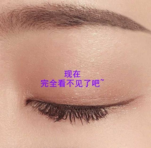 戚薇回应割双眼皮:你会怎么看待割了双眼皮的异性，如果是自己男/女朋友呢