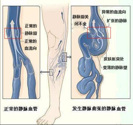 天天用热水泡脚，是真的养生还是等于慢性自杀呢？插图19