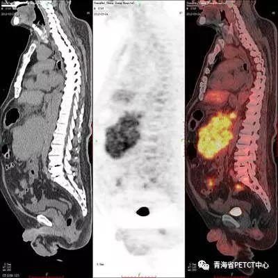 近亲家族下载:古代基本都是近亲结婚，为什么生出来的孩子没什么毛病？