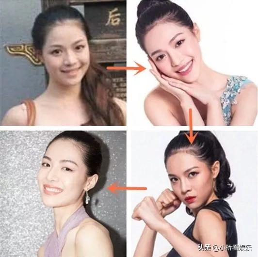 杨幂隆胸前后:为什么现在的女孩，已经长得很漂亮了还去整容？