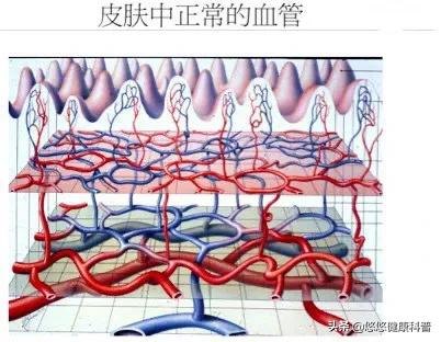 红血丝怎么去掉(脸蛋上的红血丝怎么去掉)