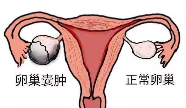 头条问答 - 腹部胀然后隐痛三个月大便每天拉一点怎么回事?(15个回答)