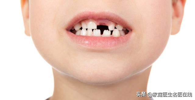 口腔疾病:口腔有哪些常见的问题会困扰人们的生活？