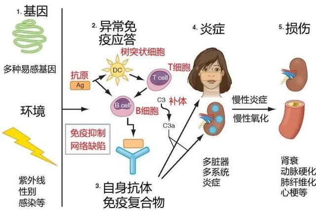 宝宝系统性红斑狼疮症状图片:系统性红斑狼疮舌头症状图片 红斑狼疮对全身每个器官损害表现出什么症状？