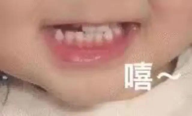 乐乐论坛科来特猫:有什么好的游戏盒吗，之前用的快吧，现在限速了？