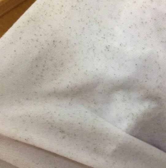 白衣服上面有发霉的黑点有什么好的方法洗干净