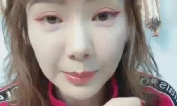 戚薇回应割双眼皮:你会怎么看待割了双眼皮的异性，如果是自己男/女朋友呢