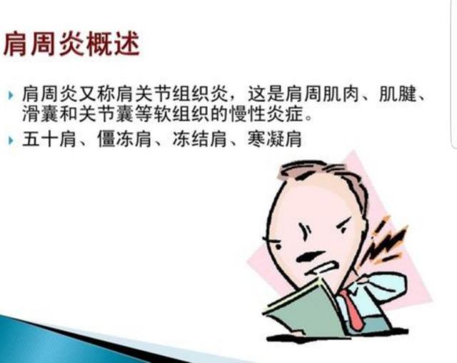 肩周炎针灸可以治好吗?-百科网