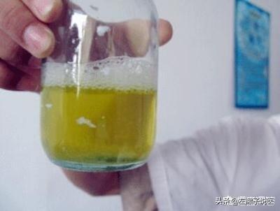萌狗俊介尿液有泡沫:狗尿不出来有什么办法催尿？