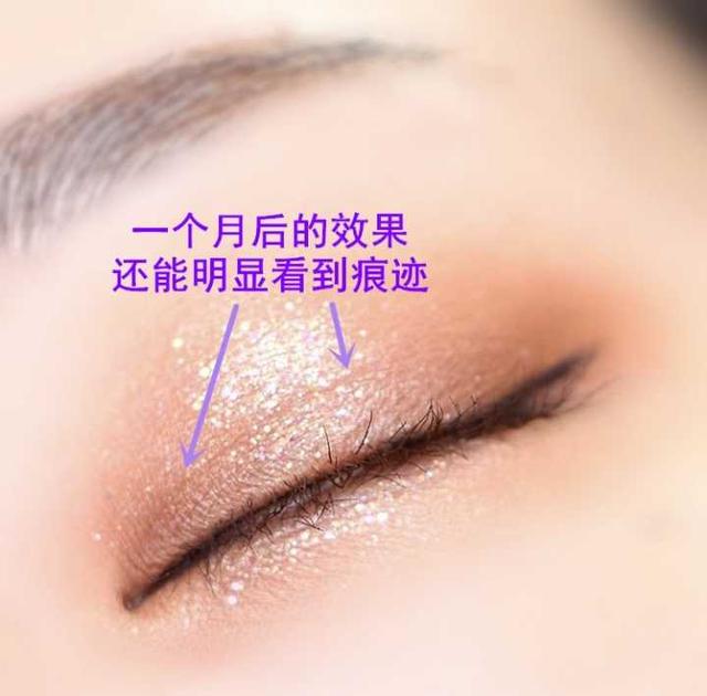 戚薇回应割双眼皮:你会怎么看待割了双眼皮的异性，如果是自己男/女朋友呢