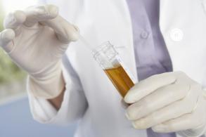 泌尿生殖系统感染:泌尿生殖系统感染用什么消炎药 哺乳期尿道感染可以吃药吗？