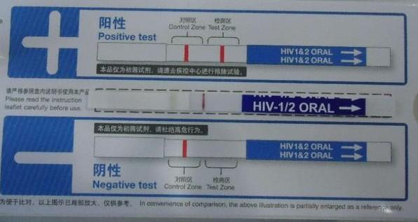 阳性阴性什么意思:医学检查中为什么叫阴性和阳性？