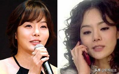熊黛林整容前:各位怎么看明星或演员整容？