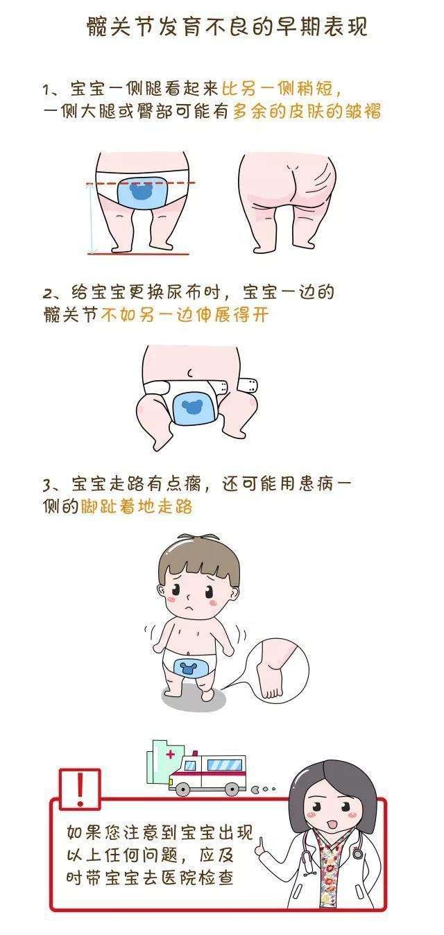 胯关节发育不良:为什么不把髋关节发育不良定为宝宝出生两个月内的必查项目？