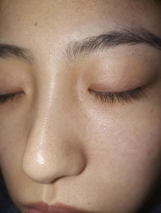 脸色暗黄该怎样调理呢