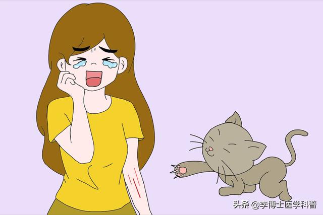 搓手猫现在怎么了:孩子被猫抓伤一个月了，没注射疫苗现在心里非常紧张，怎么办？