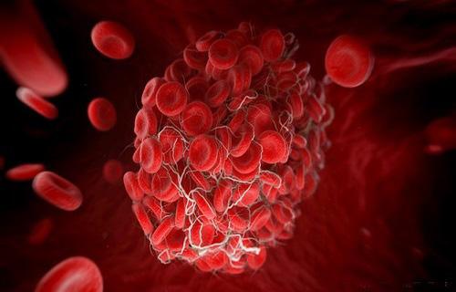 血液粘稠症状具体有哪些?-育儿网