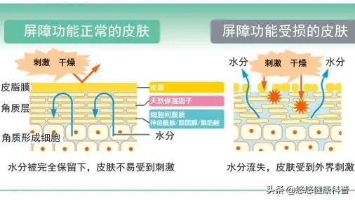 红血丝怎么去掉(脸蛋上的红血丝怎么去掉)