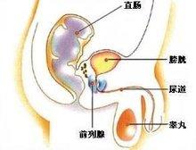 头条问答 前列腺有什么特征 9个回答