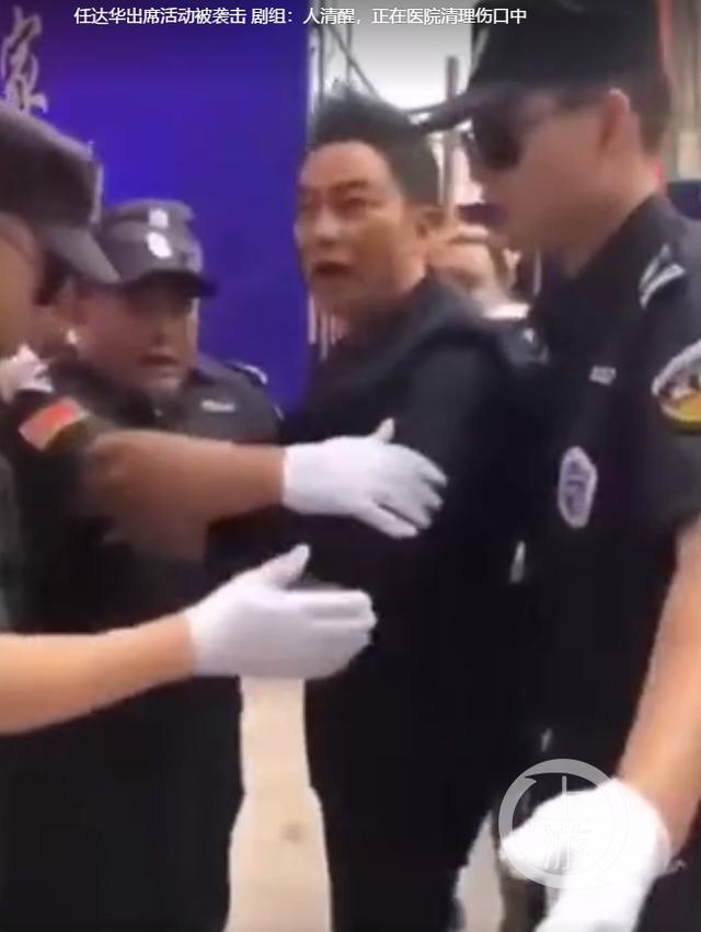 任达华首谈遇刺细节:任达华被刺事件，大家怎么看