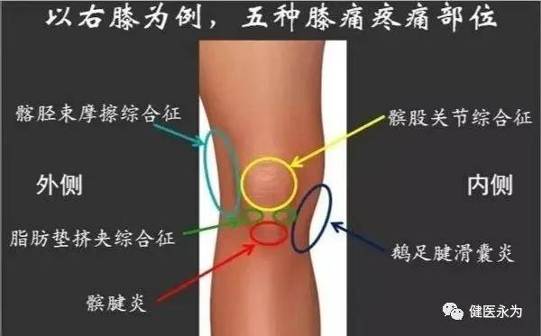 头条问答 - 膝盖以前上下楼梯疼,现在走路都疼了!怎么办?(10个回答)