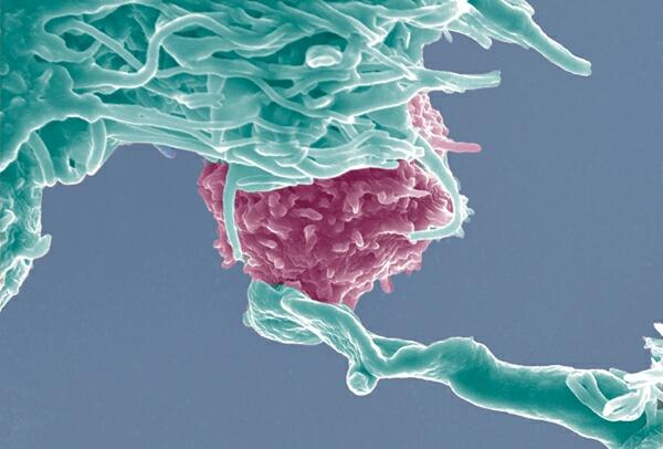 蛆虫的分泌液可以抑制免疫系统，癌症与免疫功能有什么关系增加免疫力能抗癌吗