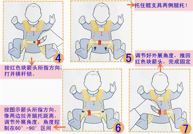 胯关节发育不良:为什么不把髋关节发育不良定为宝宝出生两个月内的必查项目？
