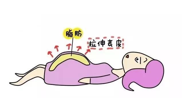 迪维霜可以去生长纹嘛:小男孩十四岁半，膝盖有生长纹还会不会长高？