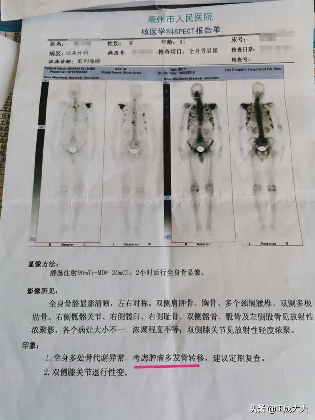 去势:公牛去势（阉割）育肥的优缺点是什么？