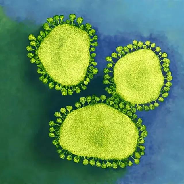 新冠病毒是怎么让人感染的-感染新冠病毒为什么能致死