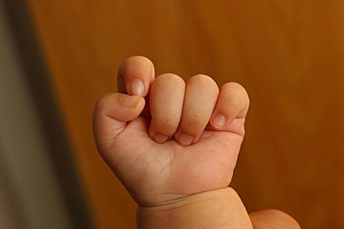 头条问答 - 婴儿头上有舅舅屎怎么洗掉?(3个回答)