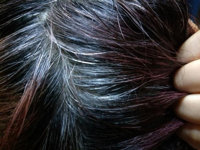 白头发又长出来了.其他网友观点1,遗传基因,不可避免.