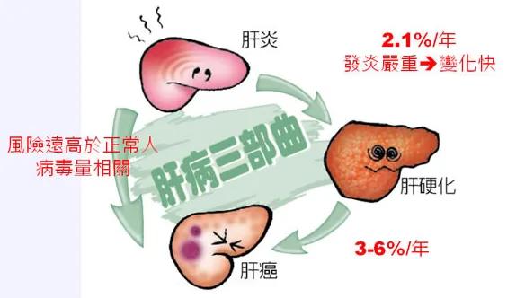 如何判断阳屡:通过什么方式能尽早知道自己是不是有肝硬化？