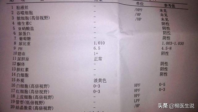 钩端螺旋体病血清:尿常规有一个潜血加号是怎么回事？